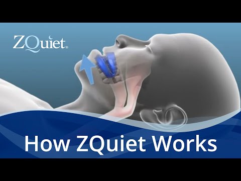 ZQuiet 2-Size Anti-Snoring Mouthpiece Starter Set With Storage Case