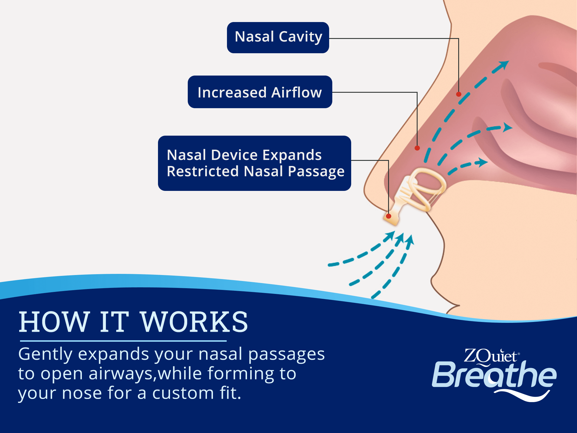 illustration showing how ZQuiet breathe works to expand nasal passages to increase airflow