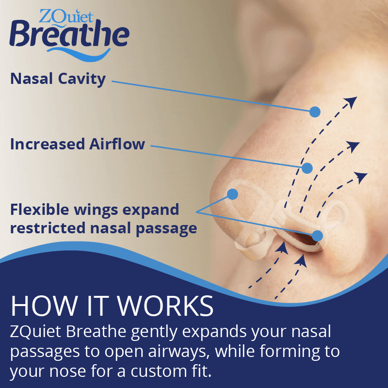 ZQuiet, Breathe, Dilatador nasal antironquidos con estuche de  almacenamiento, solución natural para ronquidos, 2 unidades, suministro  para 30 días
